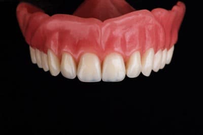 Examples of Dentures